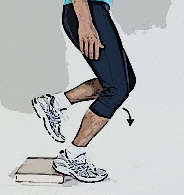 Jumpers Knee