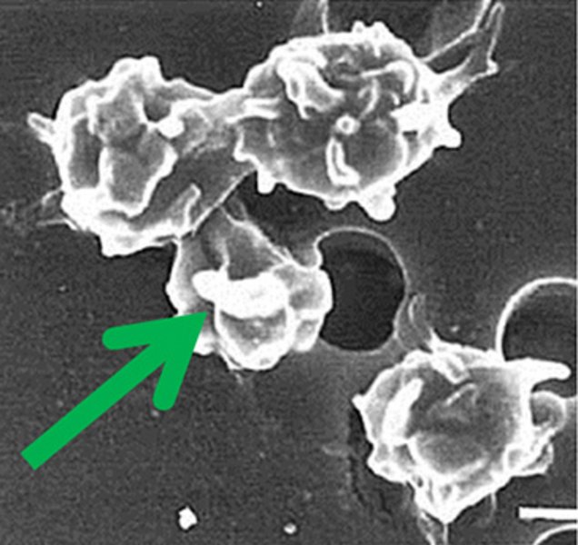 Plättchenreiches Plasma Plättchenreiches Plasma